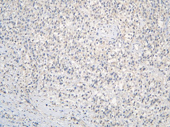 Anti-CCDC36 Antibody