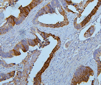 Anti-PYROXD1 Antibody