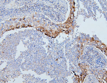 Anti-PYROXD1 Antibody