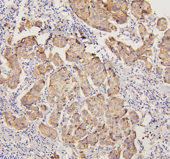 Anti-PYROXD1 Antibody