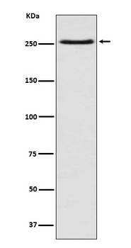 mTOR/Tor Rabbit Monoclonal Antibody