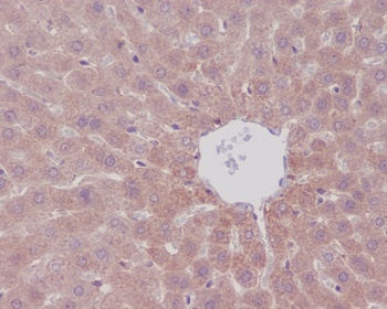 Anti-mTOR/Tor Rabbit Monoclonal Antibody