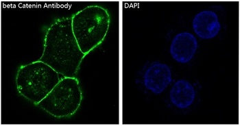 Anti-beta Catenin CTNNB1 Rabbit Monoclonal Antibody