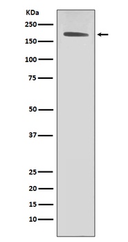 ErbB2 Rabbit Monoclonal Antibody