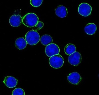 ErbB2 Rabbit Monoclonal Antibody