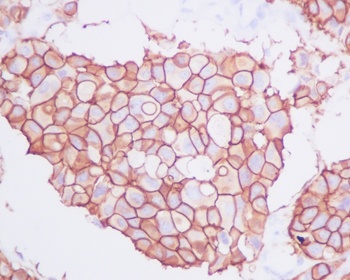 ErbB2 Rabbit Monoclonal Antibody