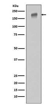 EGFR (ErbB 1) Monoclonal Antibody