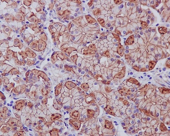 EGFR (ErbB 1) Monoclonal Antibody