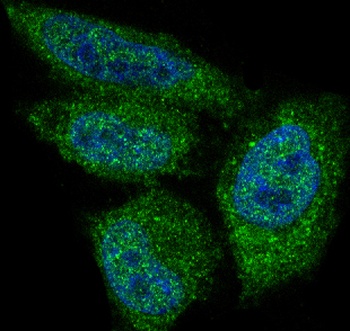 AKT1 Monoclonal Antibody