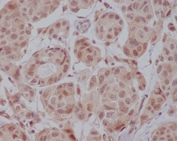 Anti-AKT1 Monoclonal Antibody
