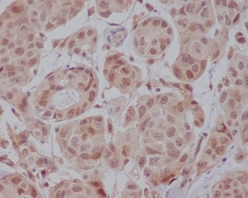 AKT1 Monoclonal Antibody