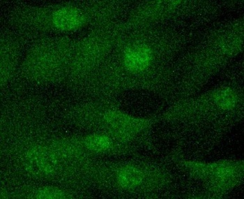 JAK2 Monoclonal Antibody