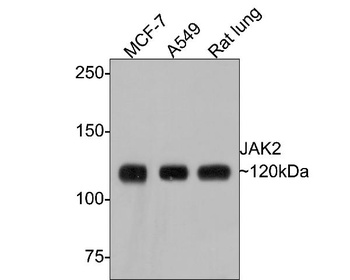Anti-JAK2 Monoclonal Antibody