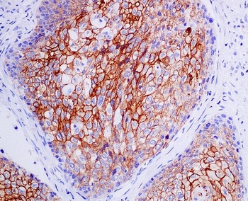 Anti-CXCR4 Monoclonal Antibody