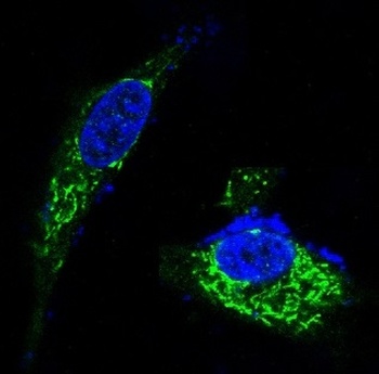BDNF Rabbit Monoclonal Antibody