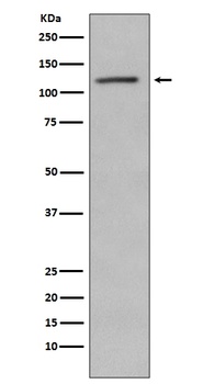 Phospho-Retinoblastoma (S780) RB1 Rabbit Monoclonal Antibody