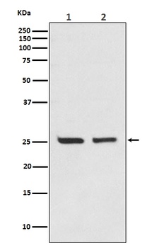 Bcl-2 Rabbit Monoclonal Antibody