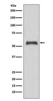 Caspase-8 CASP8 Rabbit Monoclonal Antibody