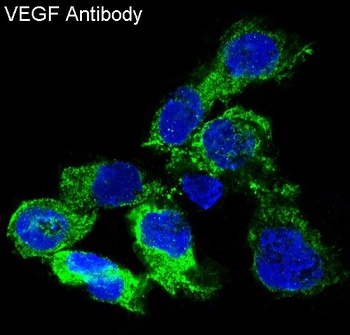 Anti-VEGF VEGFA Rabbit Monoclonal Antibody