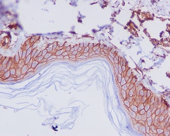 Anti-CD44 Rabbit Monoclonal Antibody