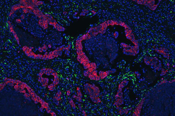 Anti-E Cadherin 1 CDH1 Antibody (monoclonal, 9G2)
