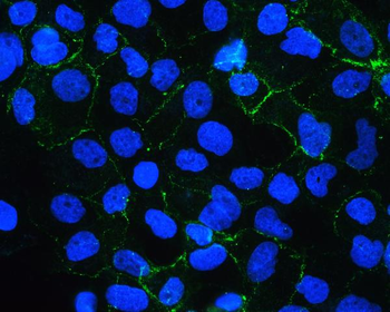 Anti-E Cadherin 1 CDH1 Antibody (monoclonal, 9G2)