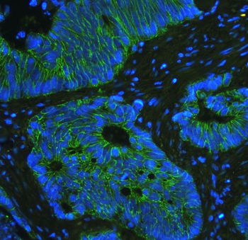 Anti-E Cadherin 1 CDH1 Antibody (monoclonal, 9G2)