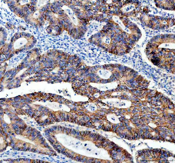 Anti-E Cadherin 1 CDH1 Antibody (monoclonal, 9G2)
