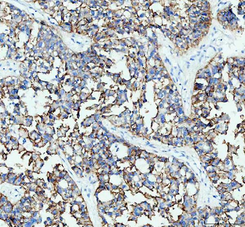 Anti-E Cadherin 1 CDH1 Antibody (monoclonal, 9G2)