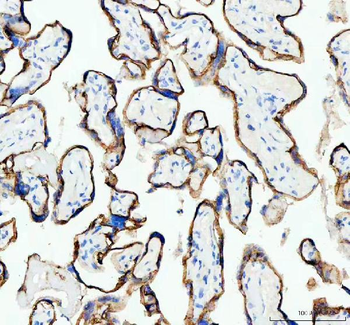 Anti-E Cadherin 1 CDH1 Antibody (monoclonal, 9G2)