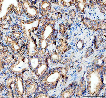 Anti-E Cadherin 1 CDH1 Antibody (monoclonal, 9G2)