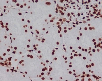 Anti-HMGB1/Hmg 1 Rabbit Monoclonal Antibody