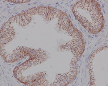 Anti-beta 2 Adrenergic Receptor ADRB2 Rabbit Monoclonal Antibody