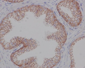 beta 2 Adrenergic Receptor ADRB2 Rabbit Monoclonal Antibody