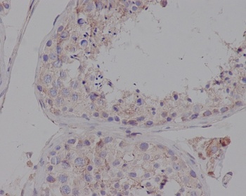 LDL Receptor Rabbit Monoclonal Antibody
