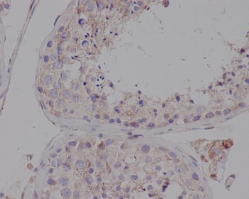 Anti-LDL Receptor Rabbit Monoclonal Antibody