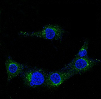 Amyloid beta A4 APP Rabbit Monoclonal Antibody