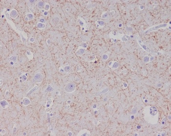 Amyloid beta A4 APP Rabbit Monoclonal Antibody