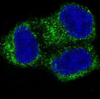 COX2 PTGS2 Rabbit Monoclonal Antibody
