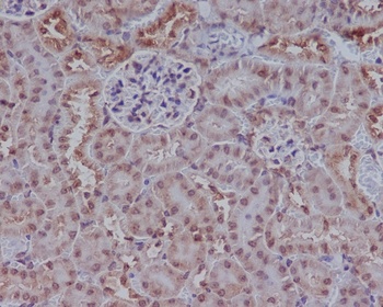 Rad51 Rabbit Monoclonal Antibody