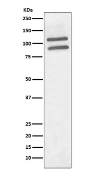 PML Rabbit Monoclonal Antibody