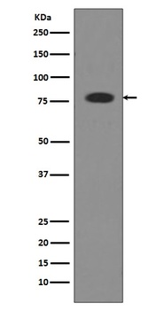 Transferrin TF Rabbit Monoclonal Antibody