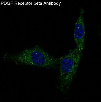 Anti-PDGF Receptor beta PDGFRB Rabbit Monoclonal Antibody