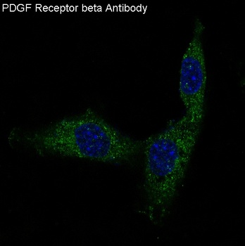 PDGF Receptor beta PDGFRB Rabbit Monoclonal Antibody