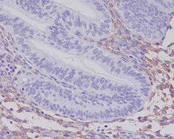 Anti-PDGF Receptor beta PDGFRB Rabbit Monoclonal Antibody