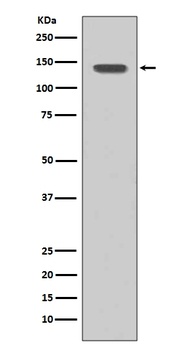 FGFR1 Rabbit Monoclonal Antibody