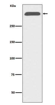 ApoB/Apolipoprotein B Rabbit Monoclonal Antibody