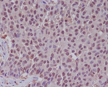 Anti-ERK1 MAPK3 Rabbit Monoclonal Antibody