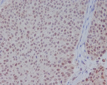 Anti-ERK1 MAPK3 Rabbit Monoclonal Antibody