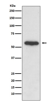 Src Rabbit Monoclonal Antibody